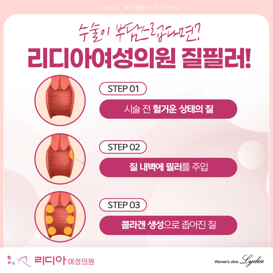강남질필러 질 이완 설명 이미지