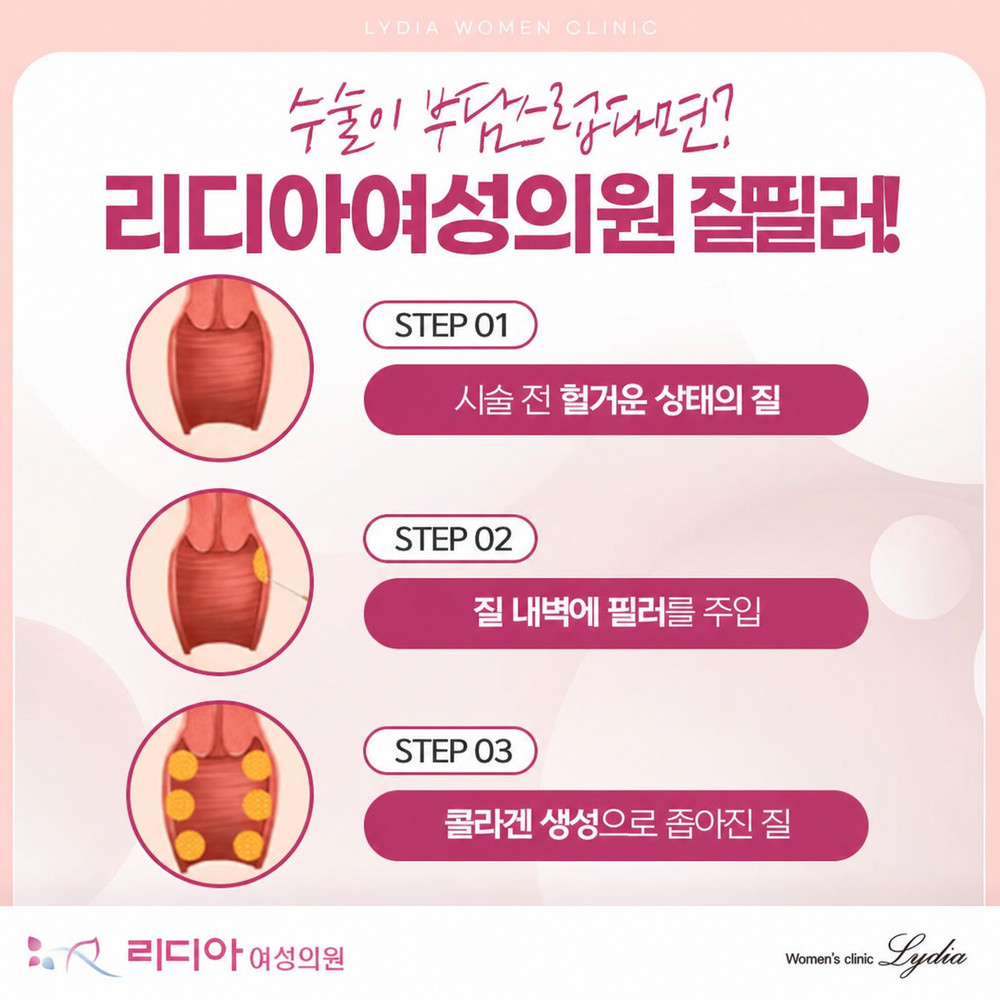 강남질필러 추천 질 건조증과 탄력 저하 고민 완화 전 알아둘 변화 기준 핵심