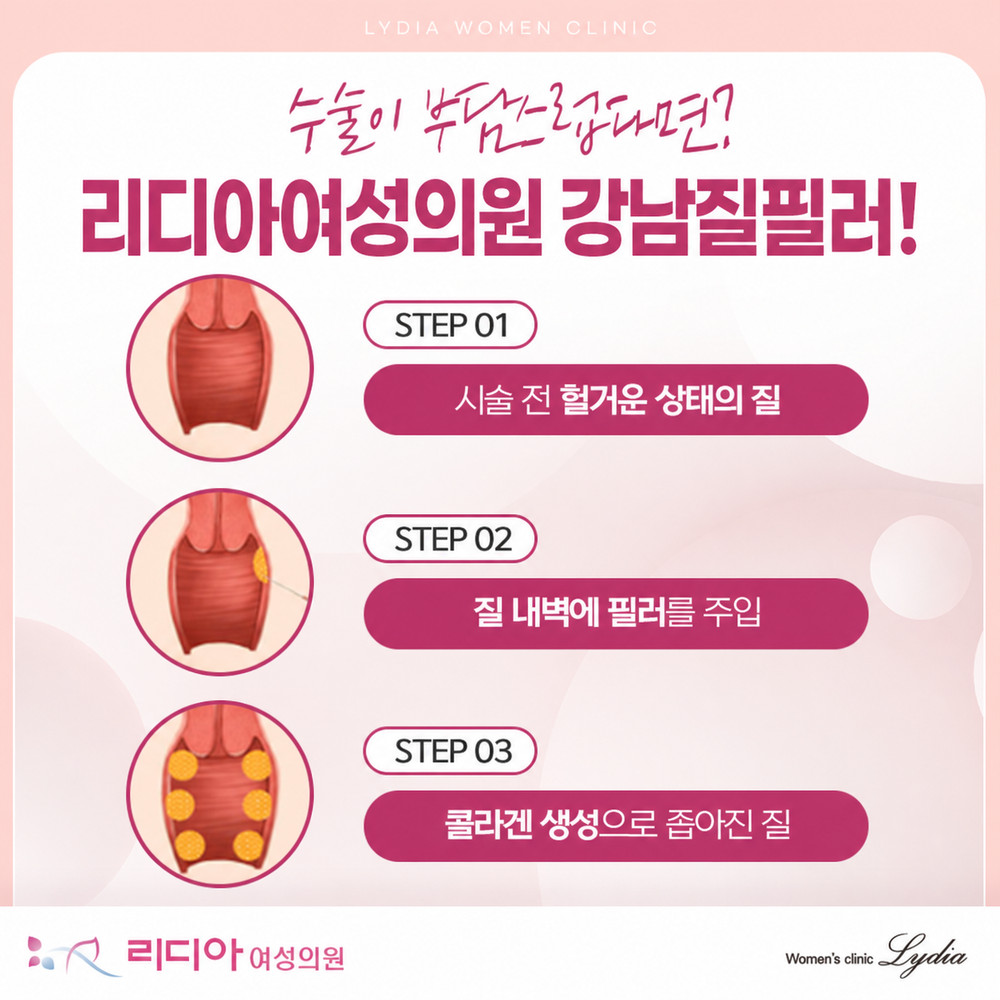 강남질필러 상담 전 웃음 기침 일상 불편감과 출산 이후 변화 확인 중요