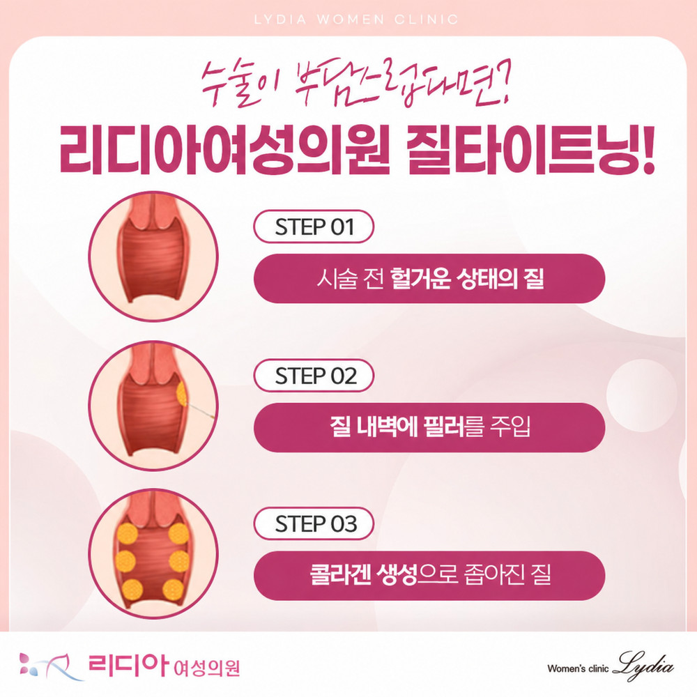 웃거나 기침할 때 불편감을 느끼는 강남질타이트닝 상담 전 상황