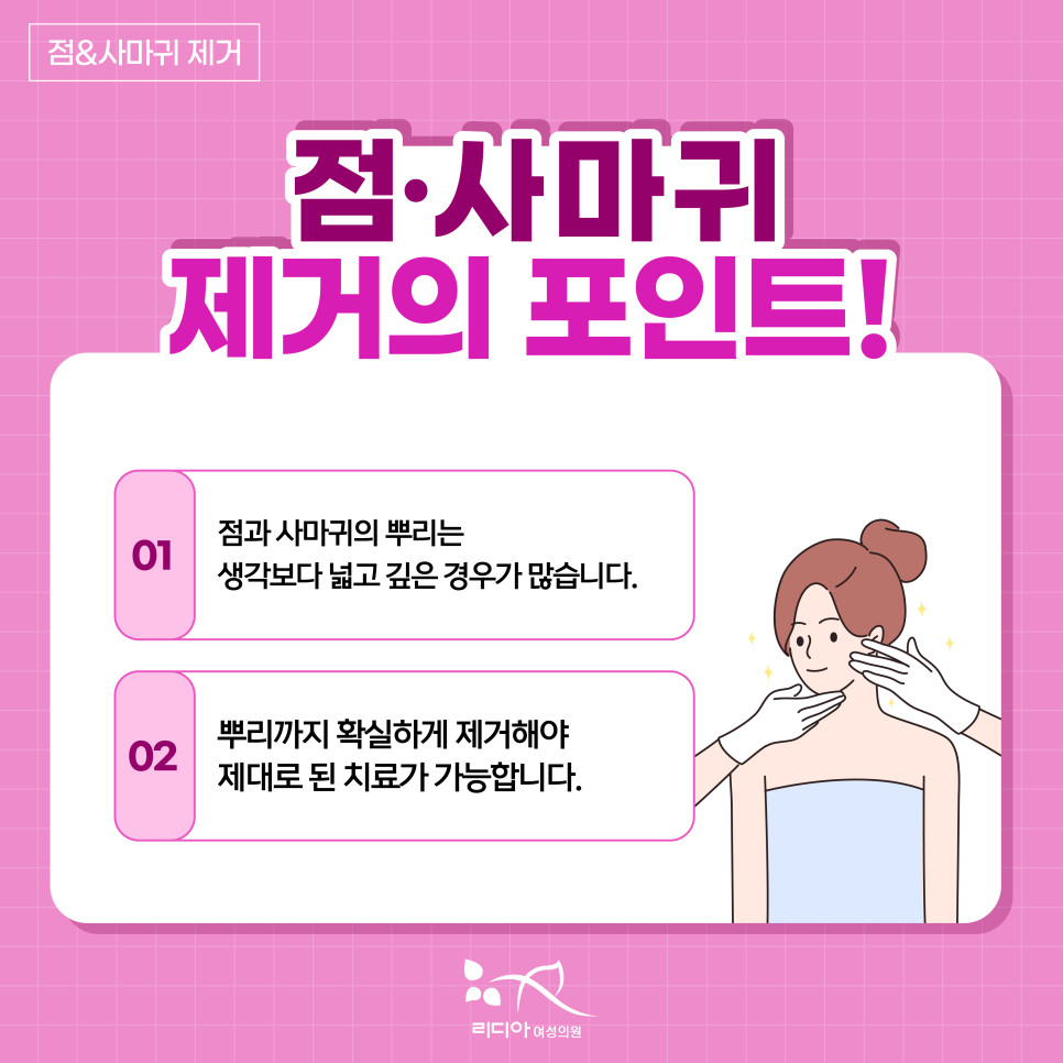 흑갈색 모반의 형태를 확인하는 피부 진단