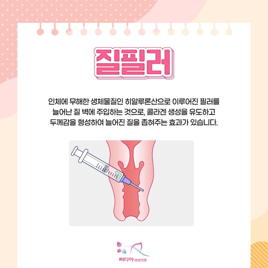질 점막과 주변 근육이 느슨해진 질이완증 상태