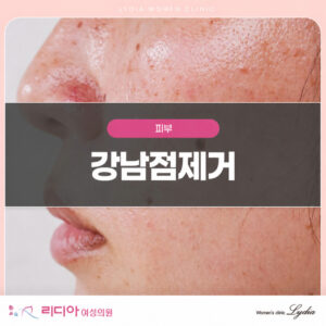 색과 크기별로 점의 형태를 살피는 상담