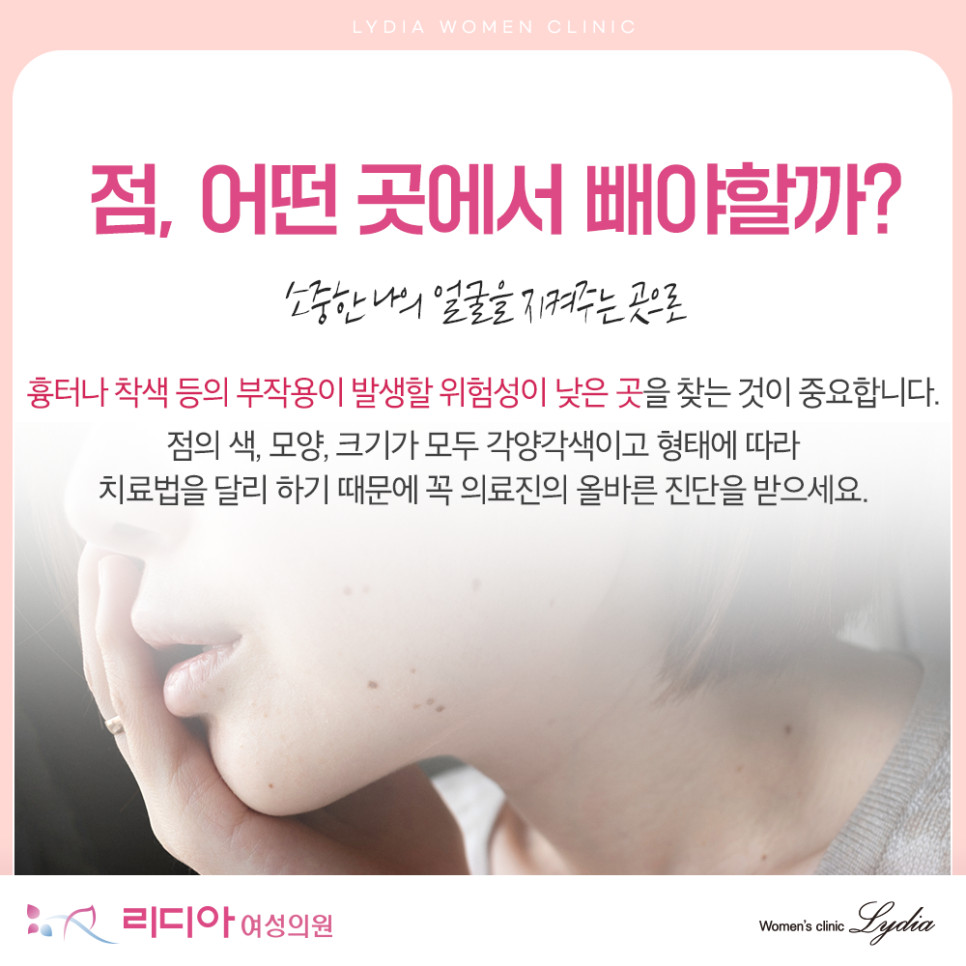 깔끔한 인상을 위해 선택하는 강남점제거 시술