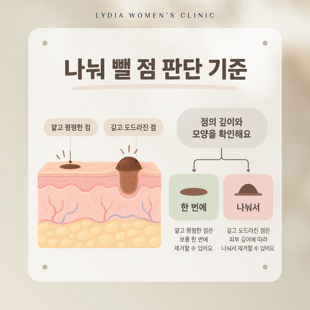 점의 깊이와 최근 변화, 상처 부위로 한 번에 뺄 점과 나눠 뺄 점을 가르는 기준