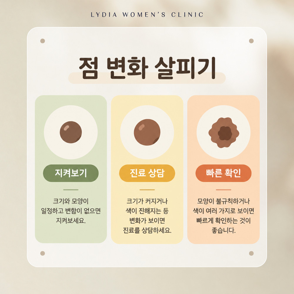 크기와 색, 경계가 변한 점을 일반 점과 구분해 살피는 관찰 기준