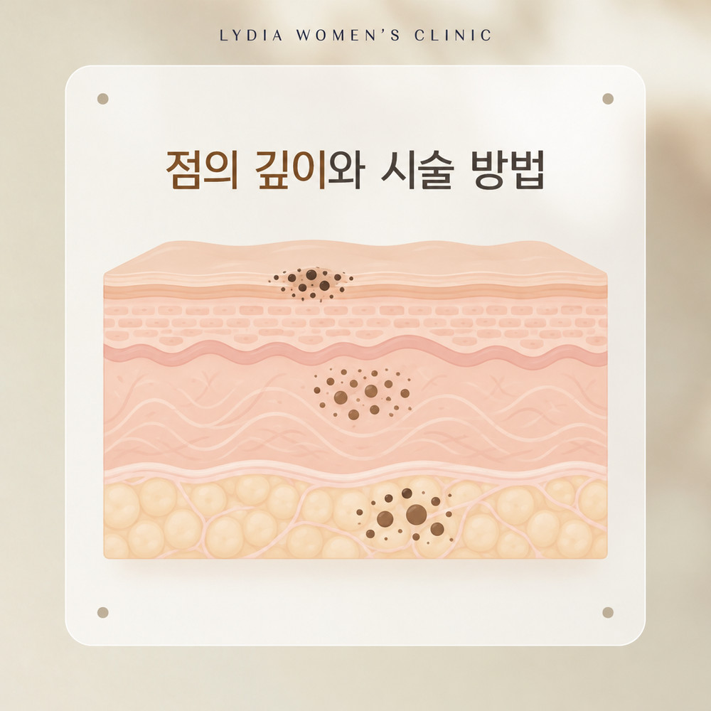 강남점빼기-점깊이-맞춤-시술